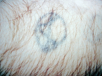 detatouageavant